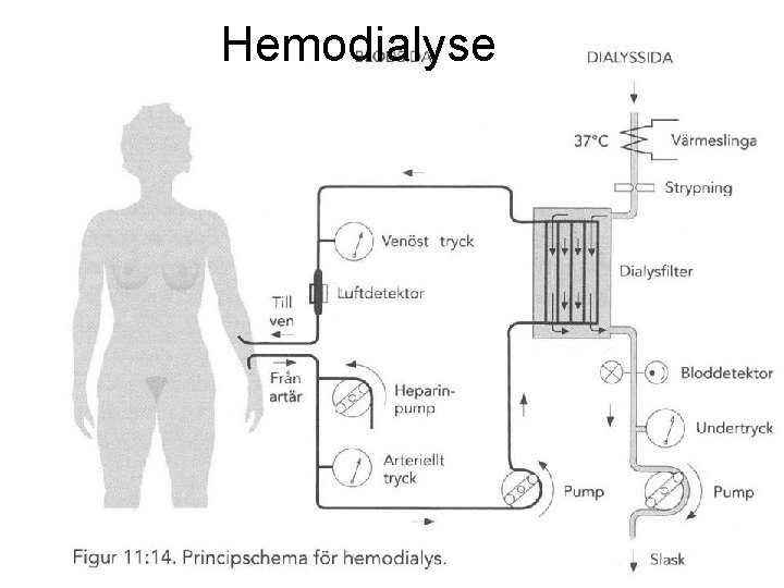Hemodialyse 80 Fysisk institutt - Rikshospitalet 