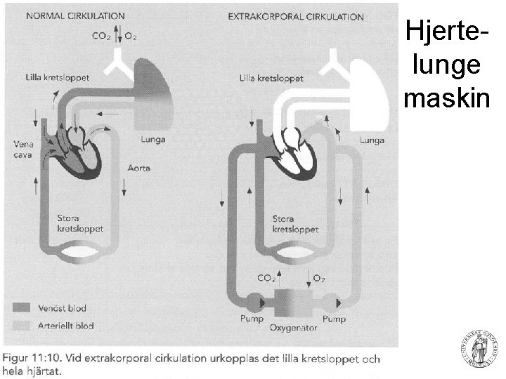 Hjertelunge maskin 82 Fysisk institutt - Rikshospitalet 