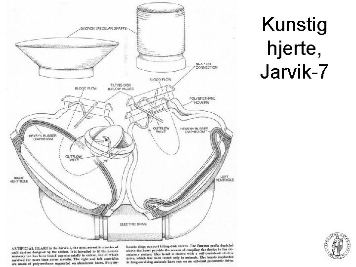 Kunstig hjerte, Jarvik-7 83 Fysisk institutt - Rikshospitalet 