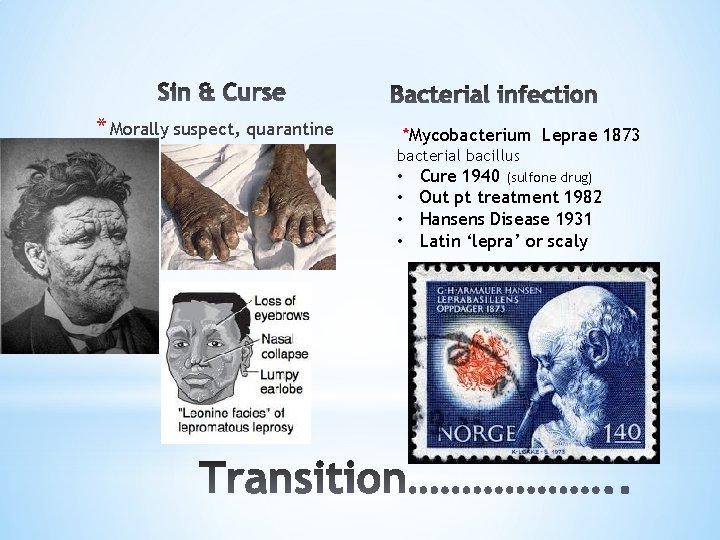 * Morally suspect, quarantine *Mycobacterium Leprae 1873 bacterial bacillus • • Cure 1940 (sulfone