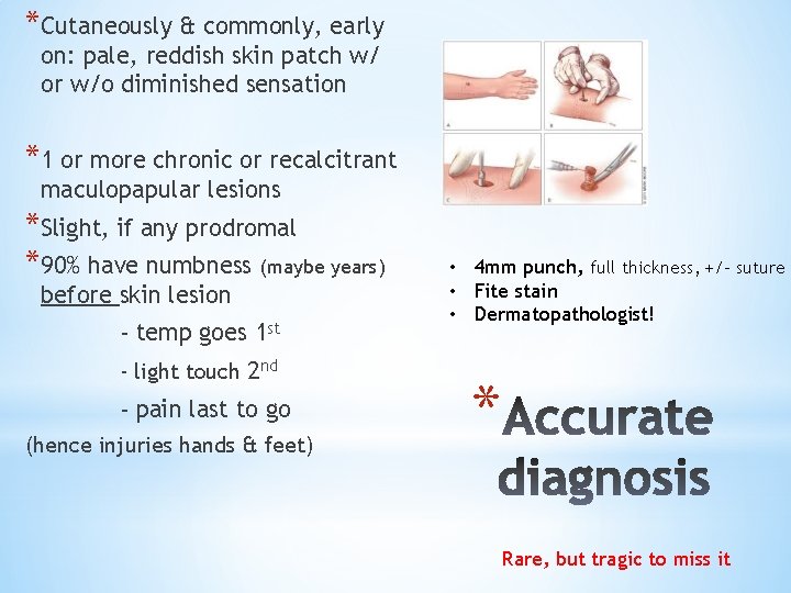 *Cutaneously & commonly, early on: pale, reddish skin patch w/ or w/o diminished sensation