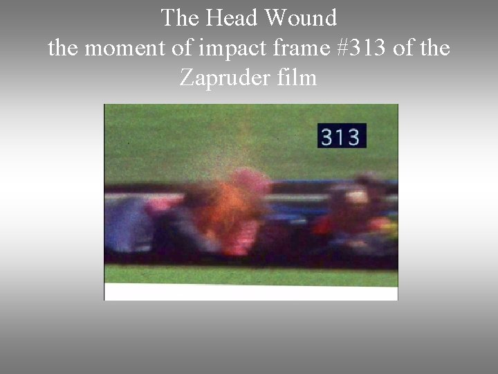 The Head Wound the moment of impact frame #313 of the Zapruder film 