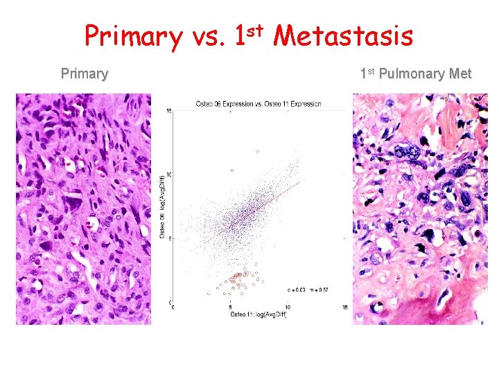 Primary vs. 1 st Metastasis Primary 1 st Pulmonary Met 