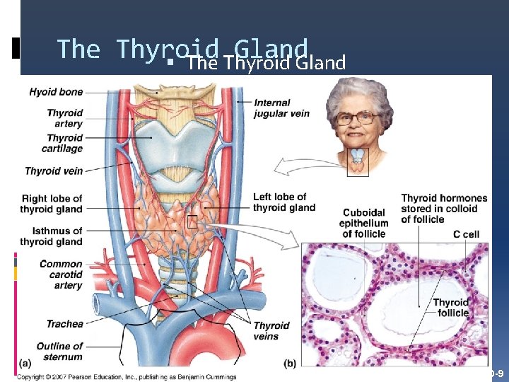 The Thyroid Gland Figure 10 -9 