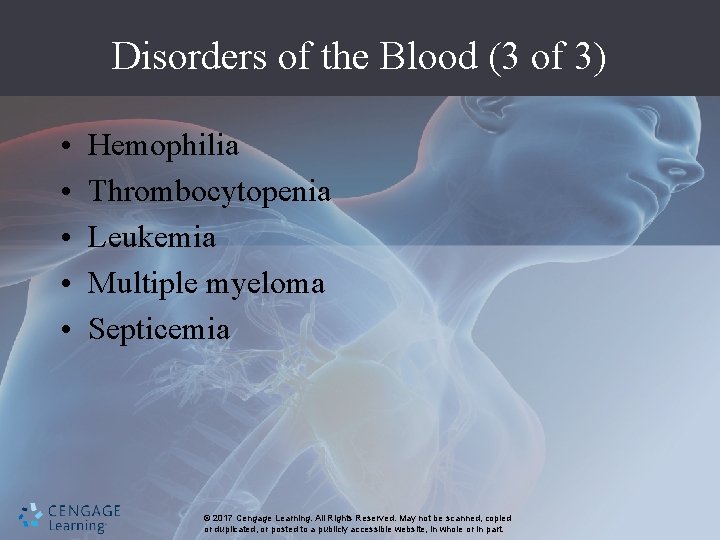 Disorders of the Blood (3 of 3) • • • Hemophilia Thrombocytopenia Leukemia Multiple