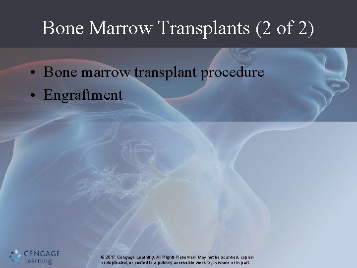 Bone Marrow Transplants (2 of 2) • Bone marrow transplant procedure • Engraftment ©