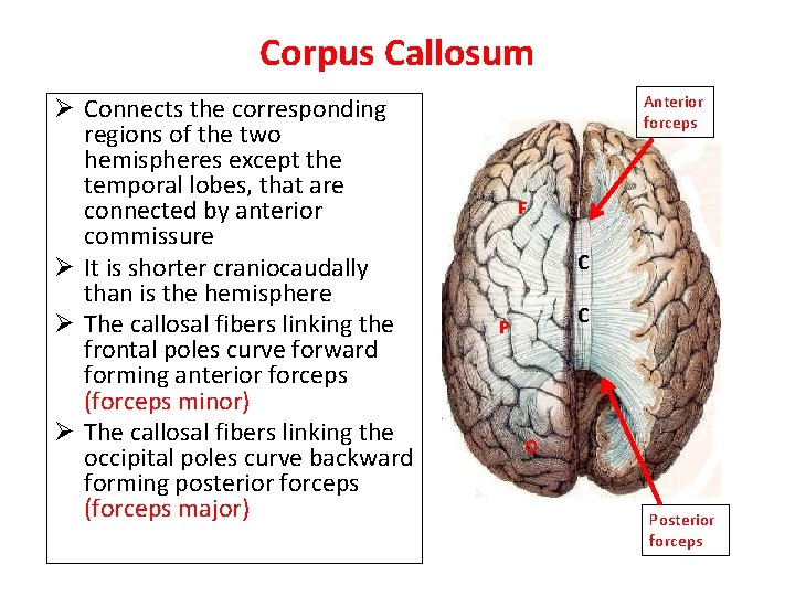 Corpus Callosum Ø Connects the corresponding regions of the two hemispheres except the temporal