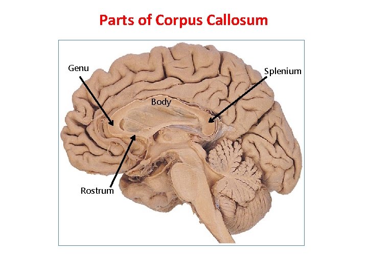 Parts of Corpus Callosum Genu Splenium Body Rostrum 