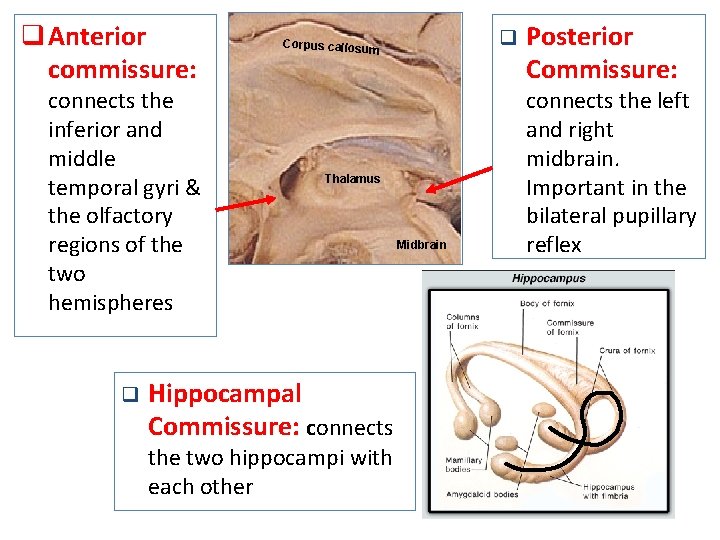 q Anterior commissure: connects the inferior and middle temporal gyri & the olfactory regions