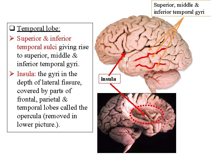 Superior, middle & inferior temporal gyri q Temporal lobe: Ø Superior & inferior temporal