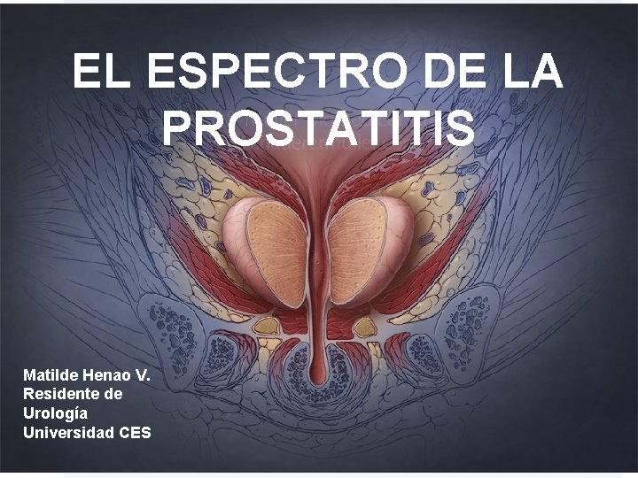 alopurinol para la prostatitis)
