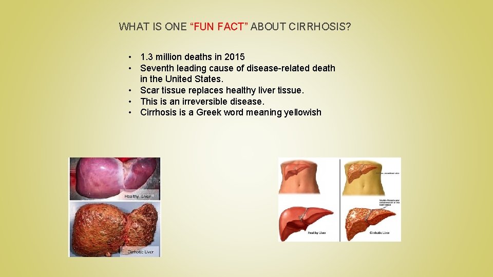 WHAT IS ONE “FUN FACT” ABOUT CIRRHOSIS? • 1. 3 million deaths in 2015