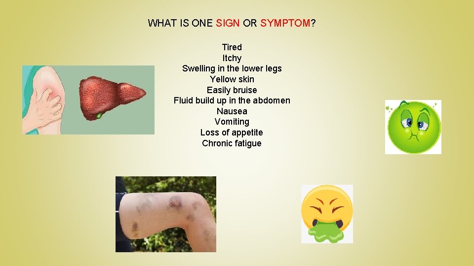 WHAT IS ONE SIGN OR SYMPTOM? Tired Itchy Swelling in the lower legs Yellow