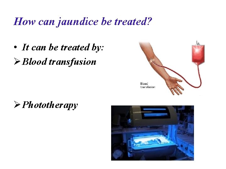 How can jaundice be treated? • It can be treated by: Ø Blood transfusion