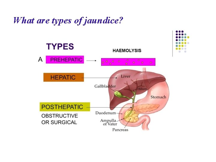 What are types of jaundice? 