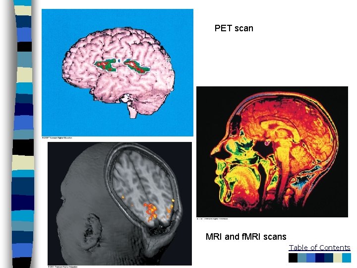 PET scan MRI and f. MRI scans Table of Contents 