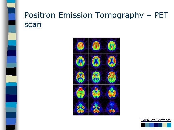 Positron Emission Tomography – PET scan Table of Contents 