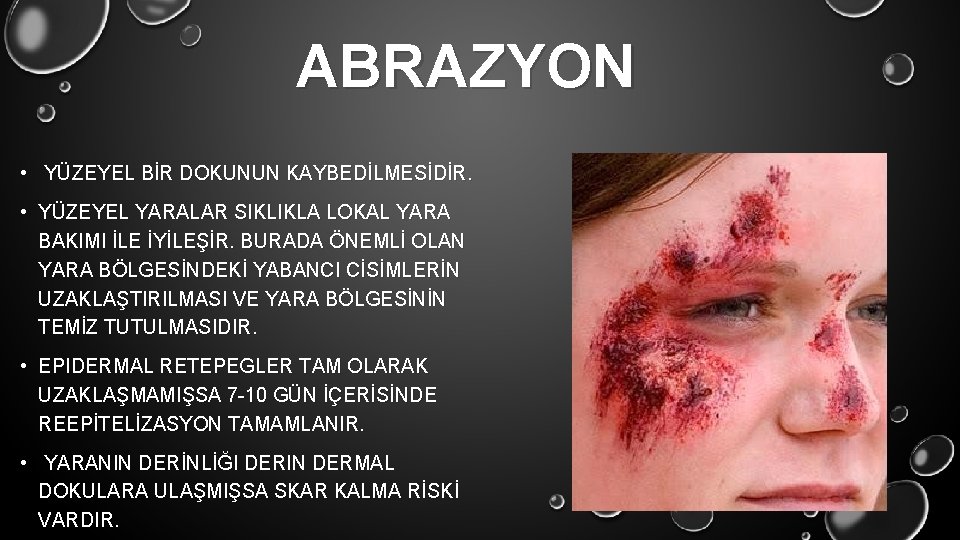 ABRAZYON • YÜZEYEL BİR DOKUNUN KAYBEDİLMESİDİR. • YÜZEYEL YARALAR SIKLIKLA LOKAL YARA BAKIMI İLE