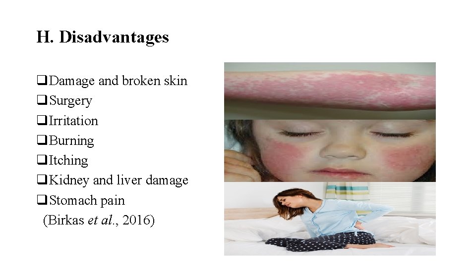 H. Disadvantages q. Damage and broken skin q. Surgery q. Irritation q. Burning q.