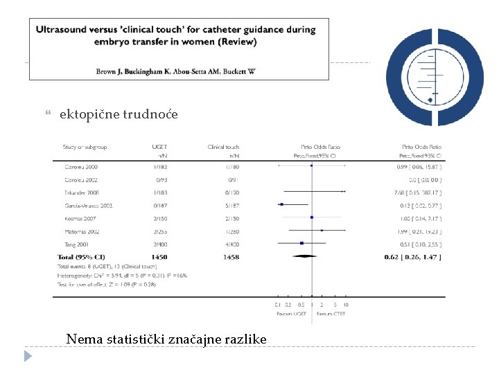  ektopične trudnoće Nema statistički značajne razlike 