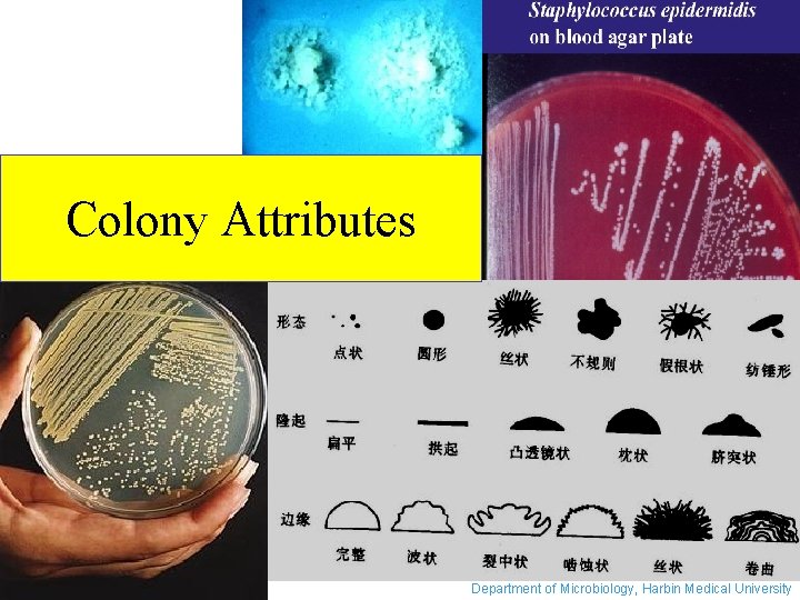 Colony Attributes Department of Microbiology, Harbin Medical University 