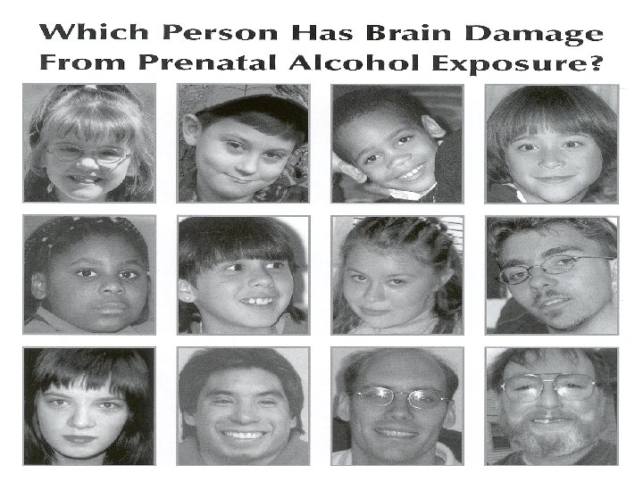 Alcohol Can Hurt an Unborn Baby Fetal Alcohol