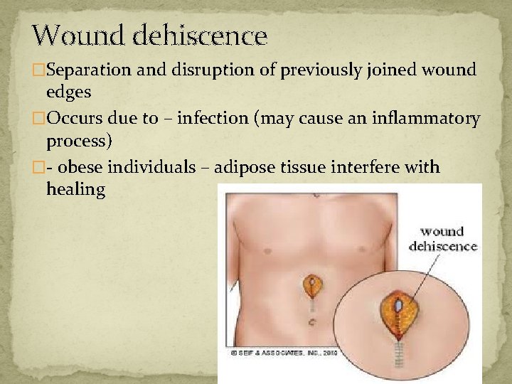 Wound dehiscence �Separation and disruption of previously joined wound edges �Occurs due to –