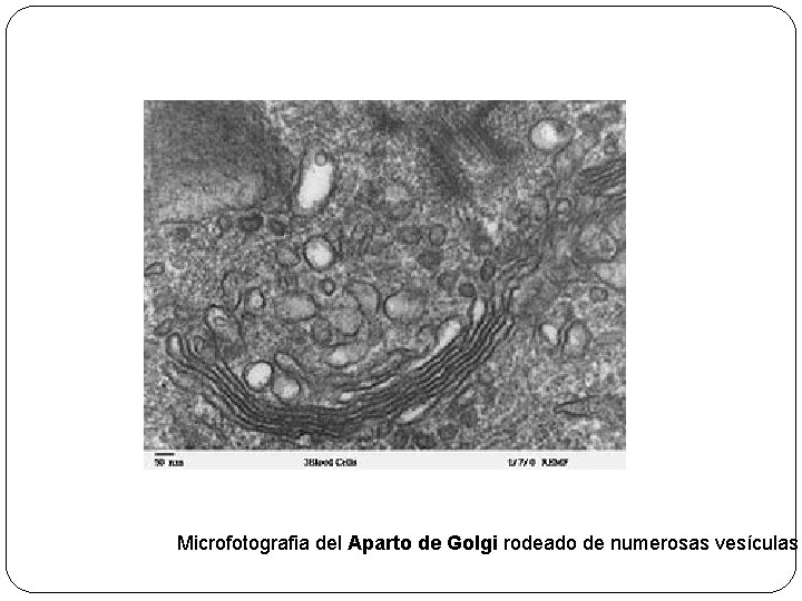 Microfotografia del Aparto de Golgi rodeado de numerosas vesículas 