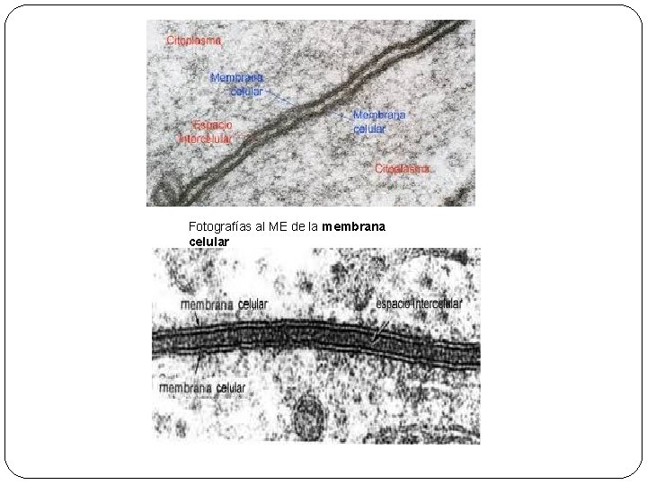 Fotografías al ME de la membrana celular 