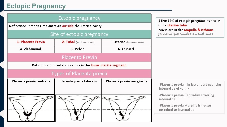 Ectopic Pregnancy Ectopic pregnancy -95 to 97% of ectopic pregnancies occurs in the uterine