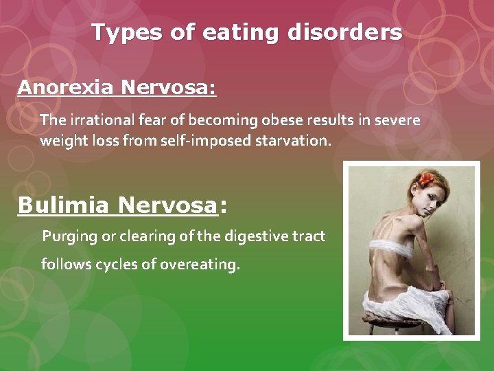 Types of eating disorders Anorexia Nervosa: The irrational fear of becoming obese results in