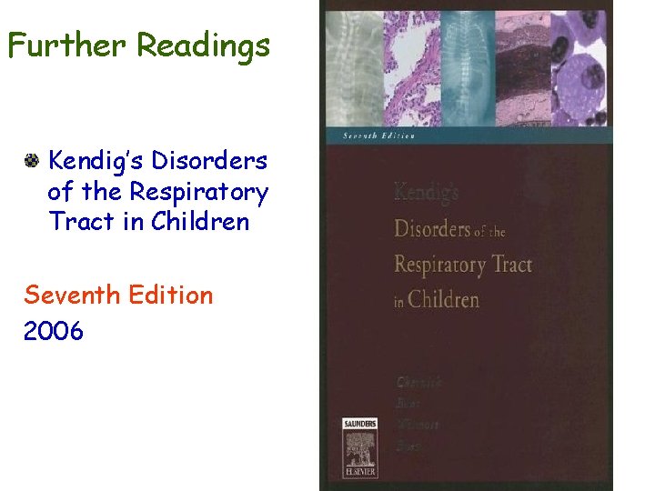 Further Readings Kendig’s Disorders of the Respiratory Tract in Children Seventh Edition 2006 