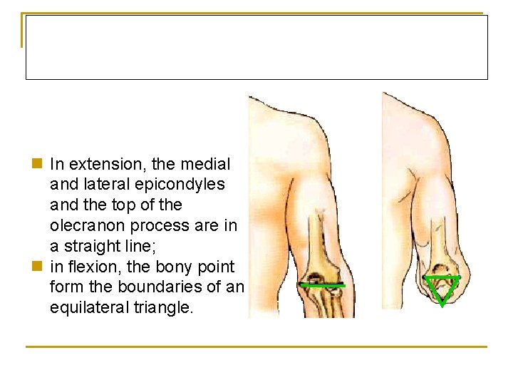 n In extension, the medial and lateral epicondyles and the top of the olecranon