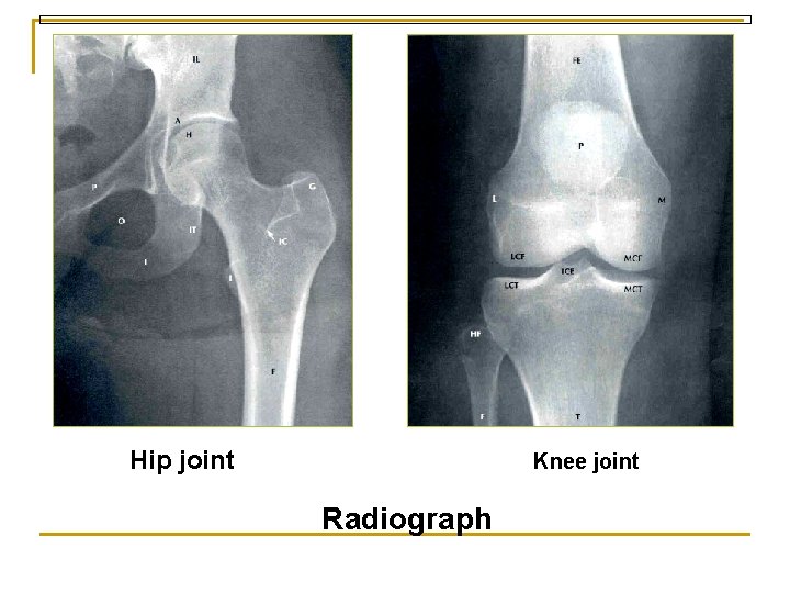 Hip joint Knee joint Radiograph 