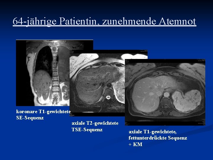 64 -jährige Patientin, zunehmende Atemnot koronare T 1 -gewichtete SE-Sequenz axiale T 2 -gewichtete