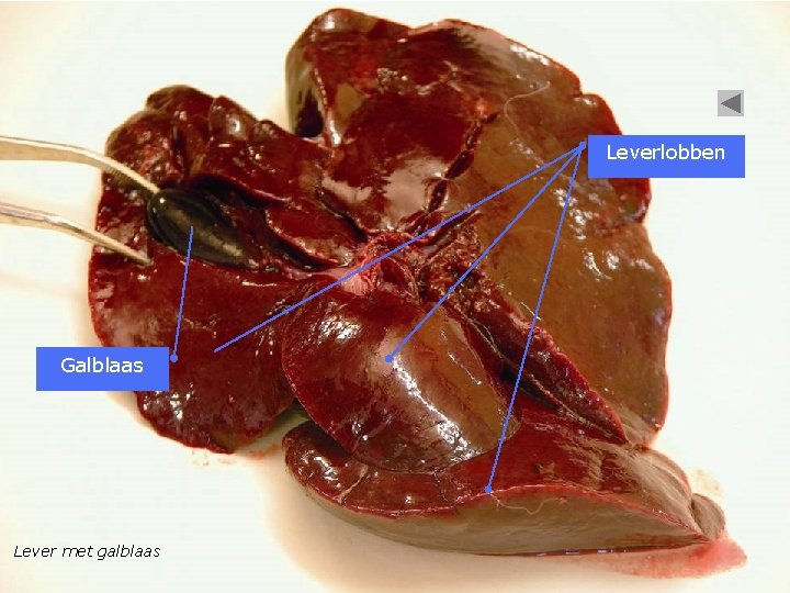 Leverlobben Galblaas Lever met galblaas 