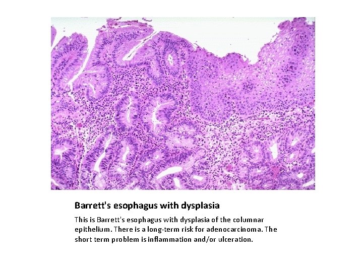 GI lab 1 esophagus and stomach Normal esophagus