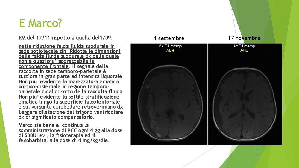 E Marco? RM del 17/11 rispetto a quella del 1/09: netta riduzione falda fluida