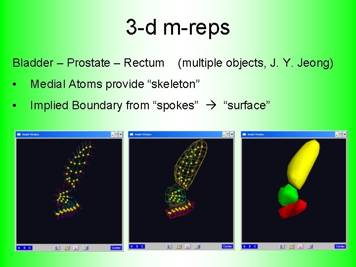 3 -d m-reps Bladder – Prostate – Rectum (multiple objects, J. Y. Jeong) •