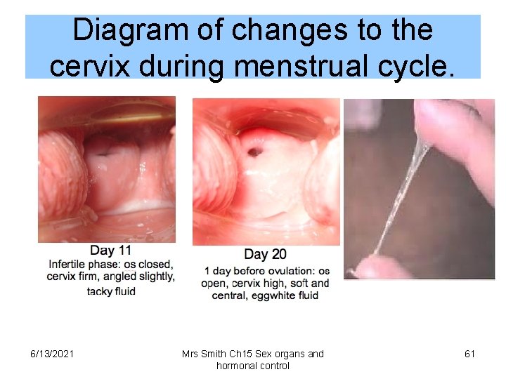 Diagram of changes to the cervix during menstrual cycle. 6/13/2021 Mrs Smith Ch 15