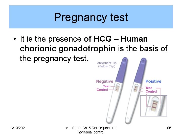 Pregnancy test • It is the presence of HCG – Human chorionic gonadotrophin is