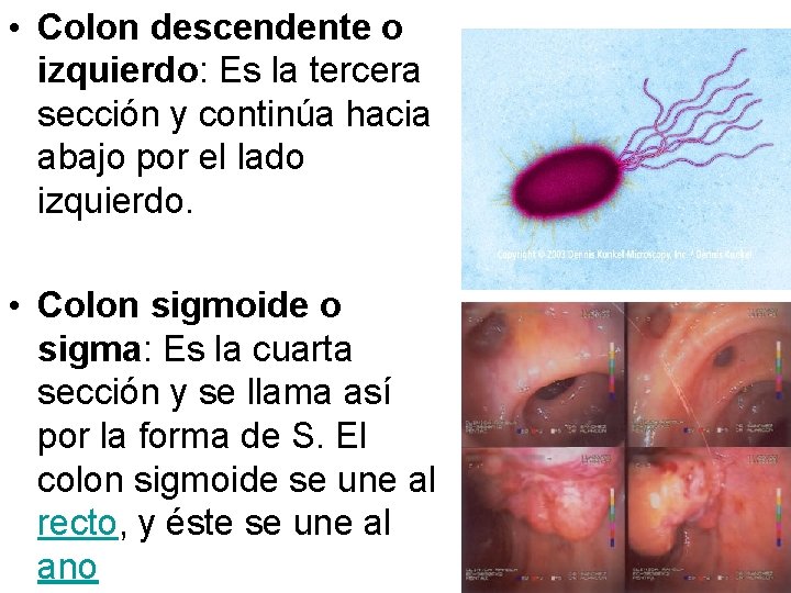 • Colon descendente o izquierdo: Es la tercera sección y continúa hacia abajo • Colon descendente o izquierdo: Es la tercera sección y continúa hacia abajo