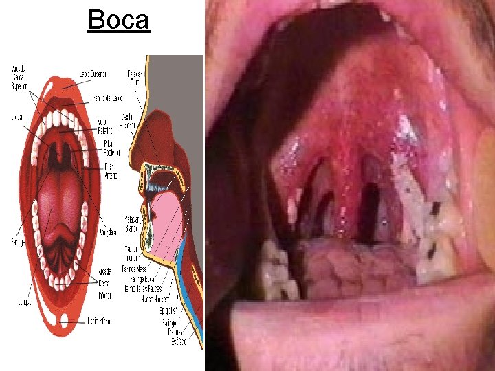 Boca 