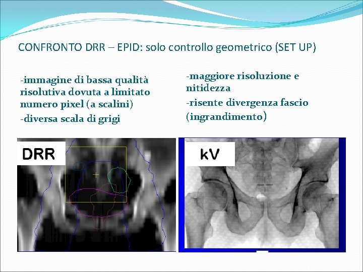 CONFRONTO DRR – EPID: solo controllo geometrico (SET UP) -immagine di bassa qualità risolutiva