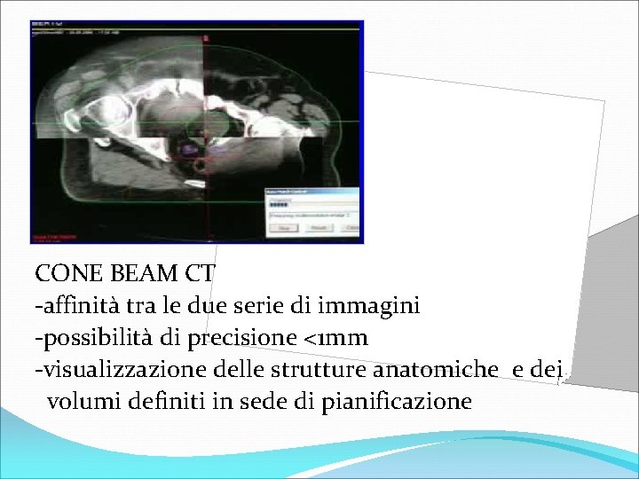 MATCHING CONE BEAM CT -affinità tra le due serie di immagini -possibilità di precisione