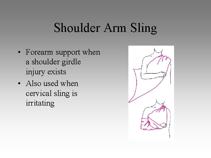 Shoulder Arm Sling • Forearm support when a shoulder girdle injury exists • Also