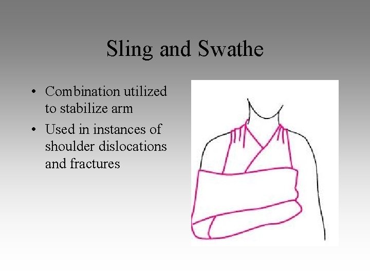 Sling and Swathe • Combination utilized to stabilize arm • Used in instances of