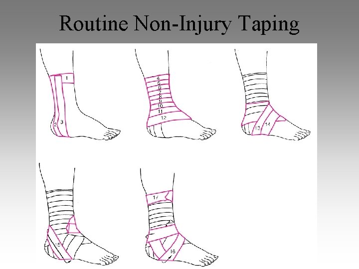 Routine Non-Injury Taping 