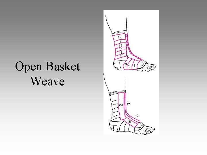 Open Basket Weave 