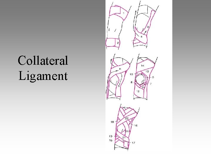 Collateral Ligament 